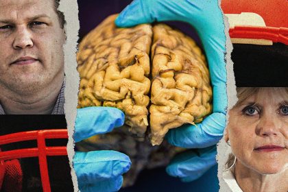 How CTE fears outran the science