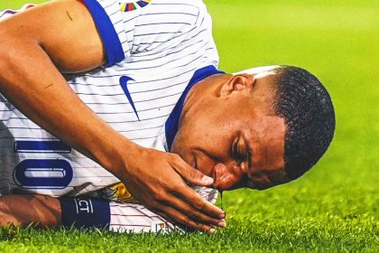 Kylian Mbappé to miss Netherlands match as he progresses from broken nose