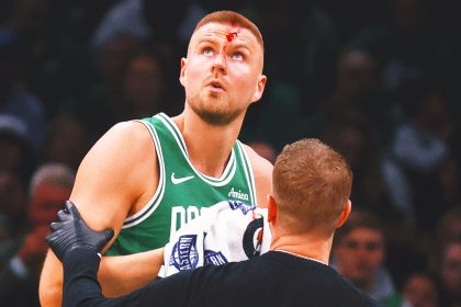 Kristaps Porzingis bloodied as Celtics take 2-0 series lead over Magic