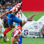 That's Gotta Hurt! Real Madrid's Kylian Mbappé Left With Bloody Gash